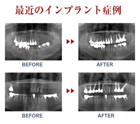 最近の症例集