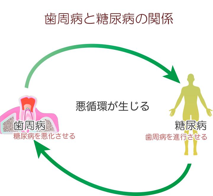 糖尿病と歯周病の関係